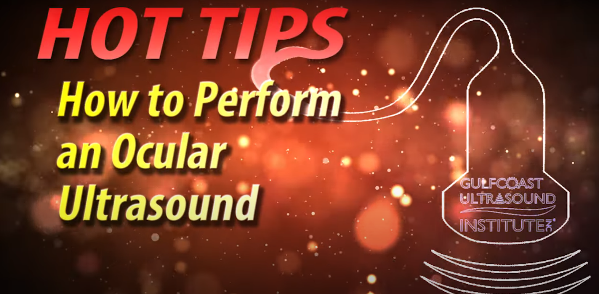 How to Perform an Ocular Ultrasound! Stephanie Doniger, MD, FACEP